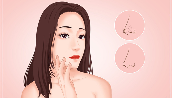 摄图网_401865623_banner_医美去黑头医疗插画（企业商用）_副本.jpg